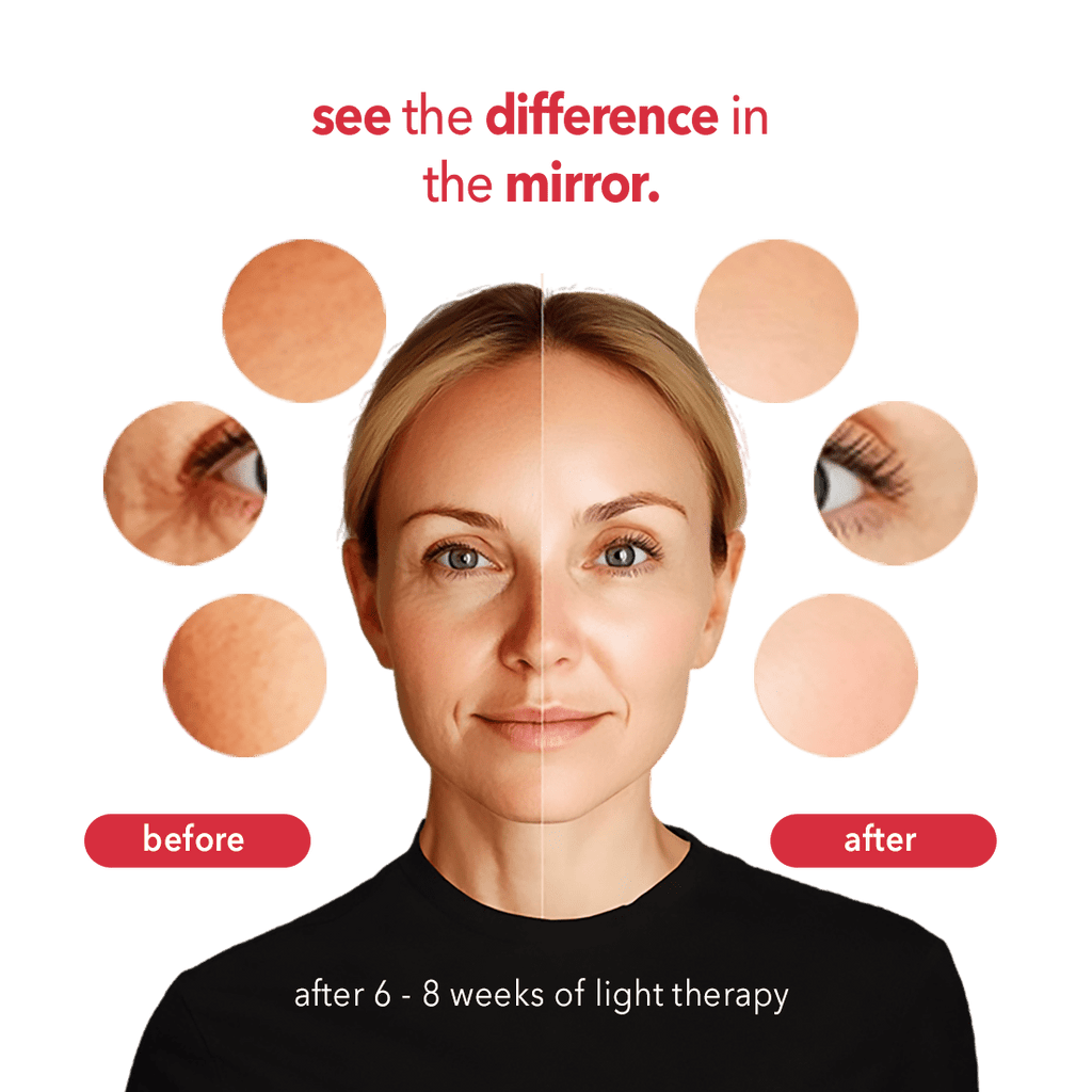 AURELUX™ LED Light Skin Rejuvenation Therapy Face Mask (black) - The Red Light Store