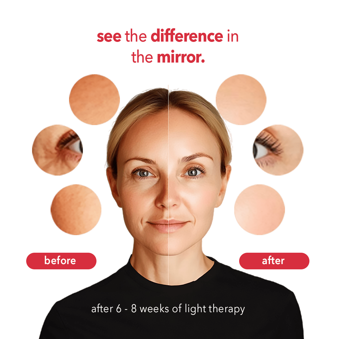 AURELUX™ LED Light Skin Rejuvenation Therapy Face Mask (white) - The Red Light Store