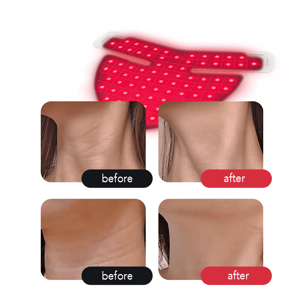 AURELUX™ LED Light Skin Rejuvenation Therapy Neck Deck (white) - The Red Light Store