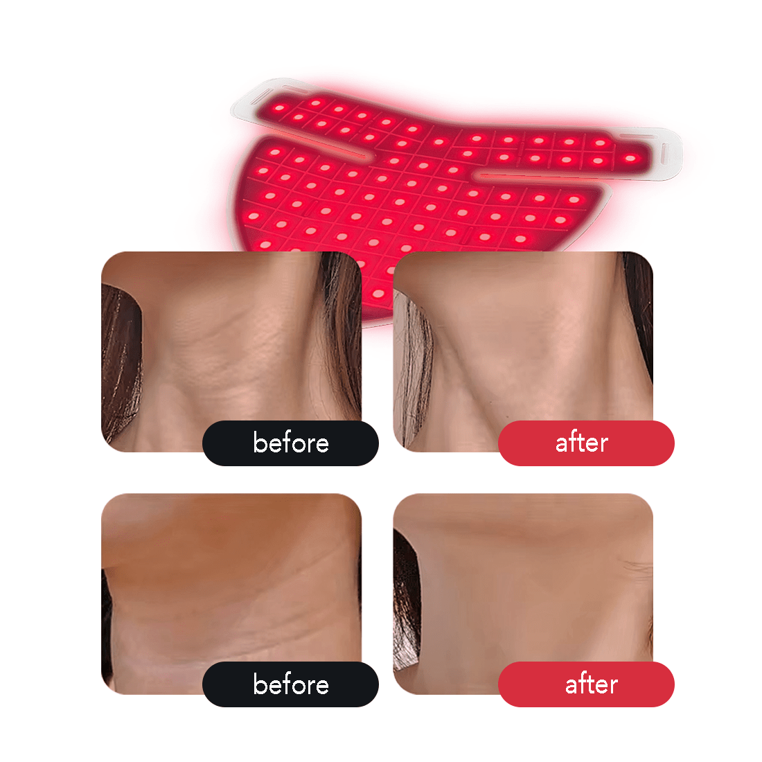 AURELUX™ LED Light Skin Rejuvenation Therapy Neck Deck (white) - The Red Light Store