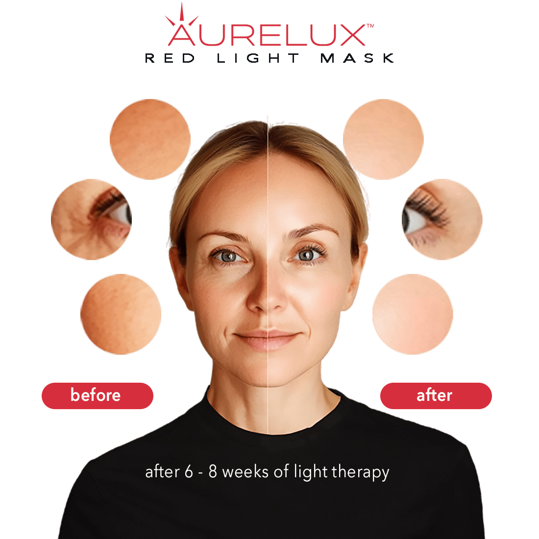 Aurelux™ LED light therapy face mask (black) - AURELUX BEAUTY