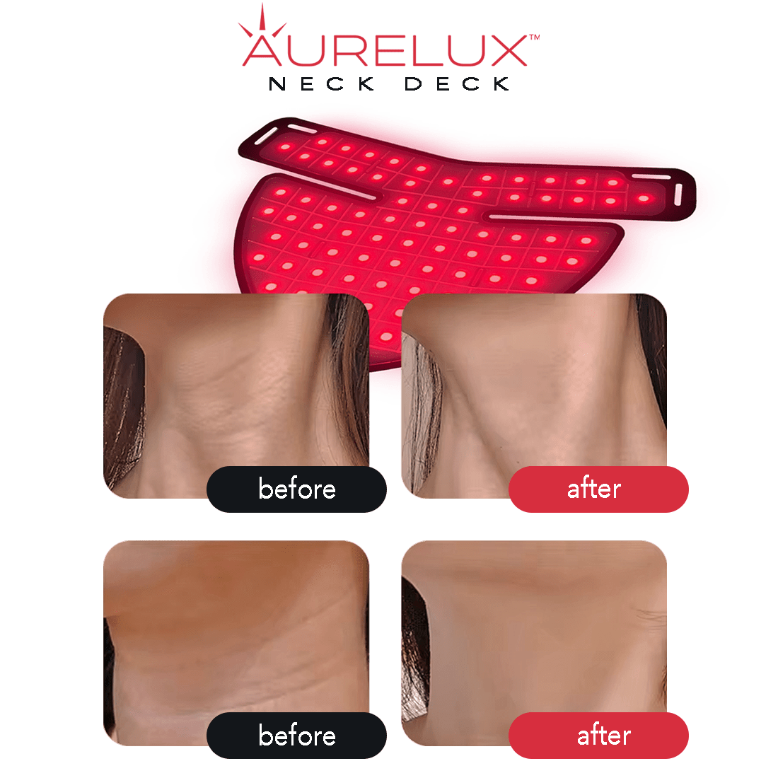 Aurelux LED red light therapy neck deck (black) - AURELUX BEAUTY