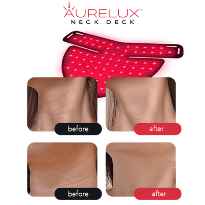 Aurelux LED red light therapy neck deck (black) - AURELUX BEAUTY