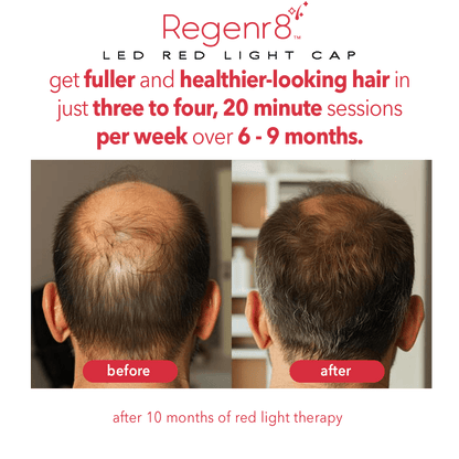 Regener8™ - LED Red Light Therapy Cap for Hair Regrowth - AURELUX BEAUTY