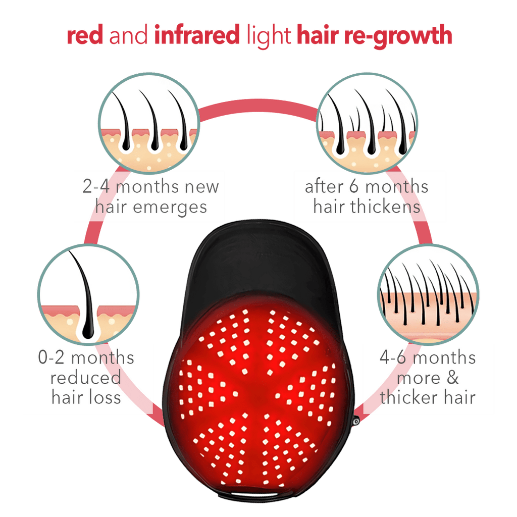 Regener8™ - LED Red Light Therapy Cap for Hair Regrowth - AURELUX BEAUTY