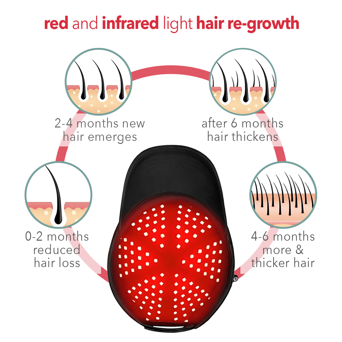 Regener8™ - LED Red Light Therapy Cap for Hair Regrowth - AURELUX BEAUTY