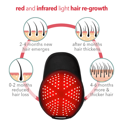 Regener8™ - LED Red Light Therapy Cap for Hair Regrowth - AURELUX BEAUTY