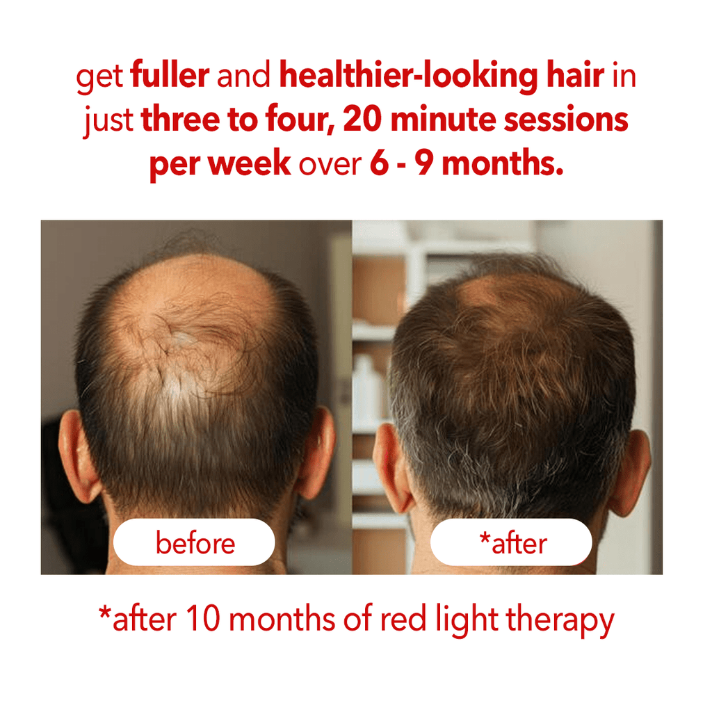 Regenr8™ - LED Red Light Therapy Cap for Hair Growth - The Red Light Store