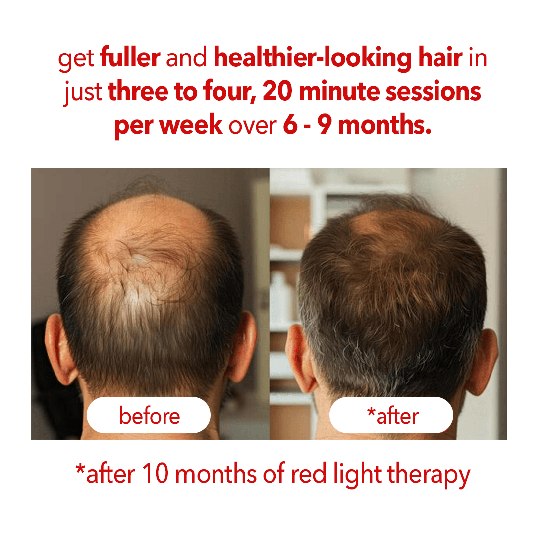 Regenr8™ - LED Red Light Therapy Cap for Hair Growth - The Red Light Store