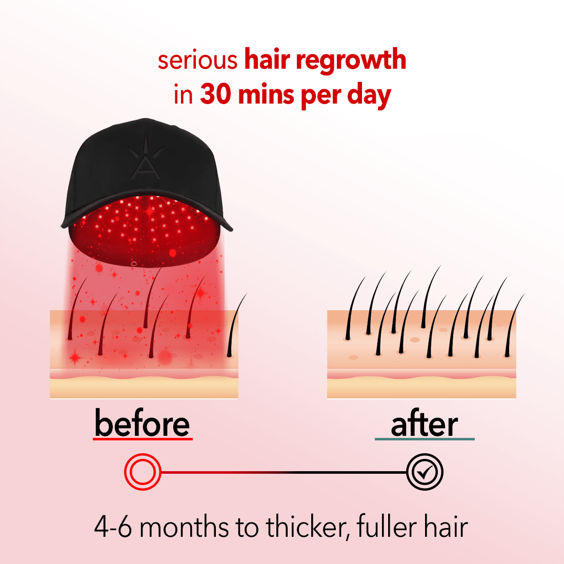 Regenr8™ - LED Red Light Therapy Cap for Hair Growth - The Red Light Store