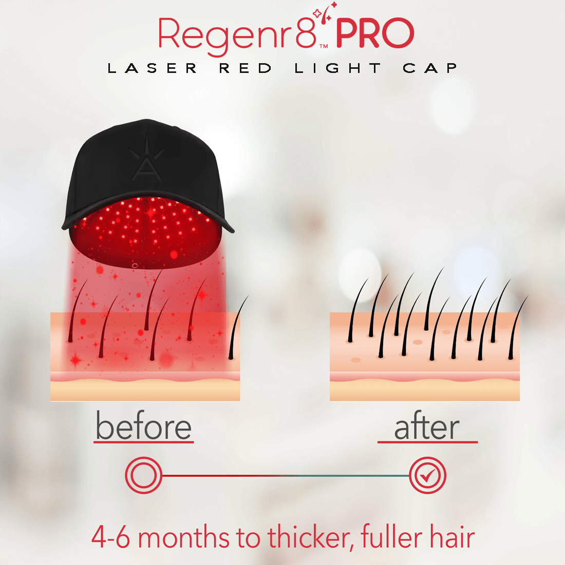 Regenr8™ Pro - 272 Laser Red Light Therapy Cap for Hair Growth (Black) - The Red Light Store