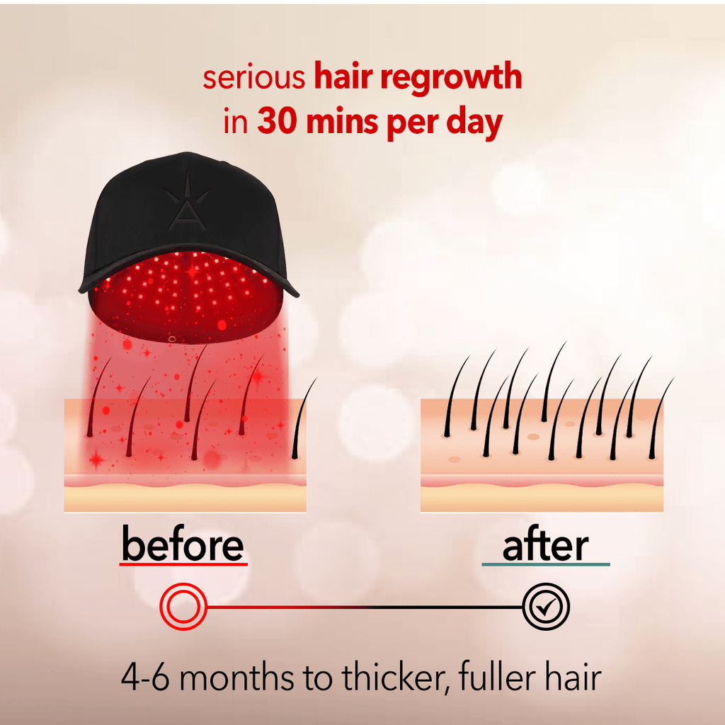 Regenr8™ Pro - 272 Laser Red Light Therapy Cap for Hair Growth (Black) - The Red Light Store