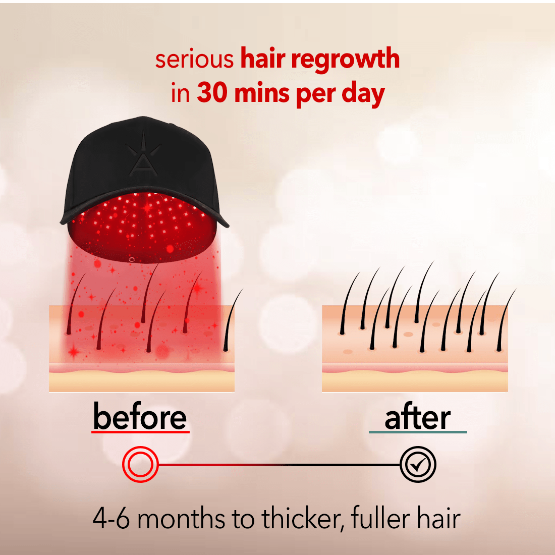 Regenr8™ Pro - 272 Laser Red Light Therapy Cap for Hair Growth (Black) - The Red Light Store
