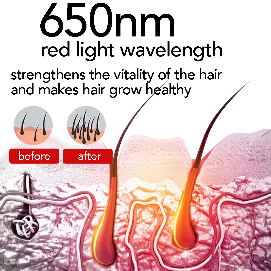 Regenr8™ Pro - 272 Laser Red Light Therapy Cap for Hair Growth (Black) - The Red Light Store