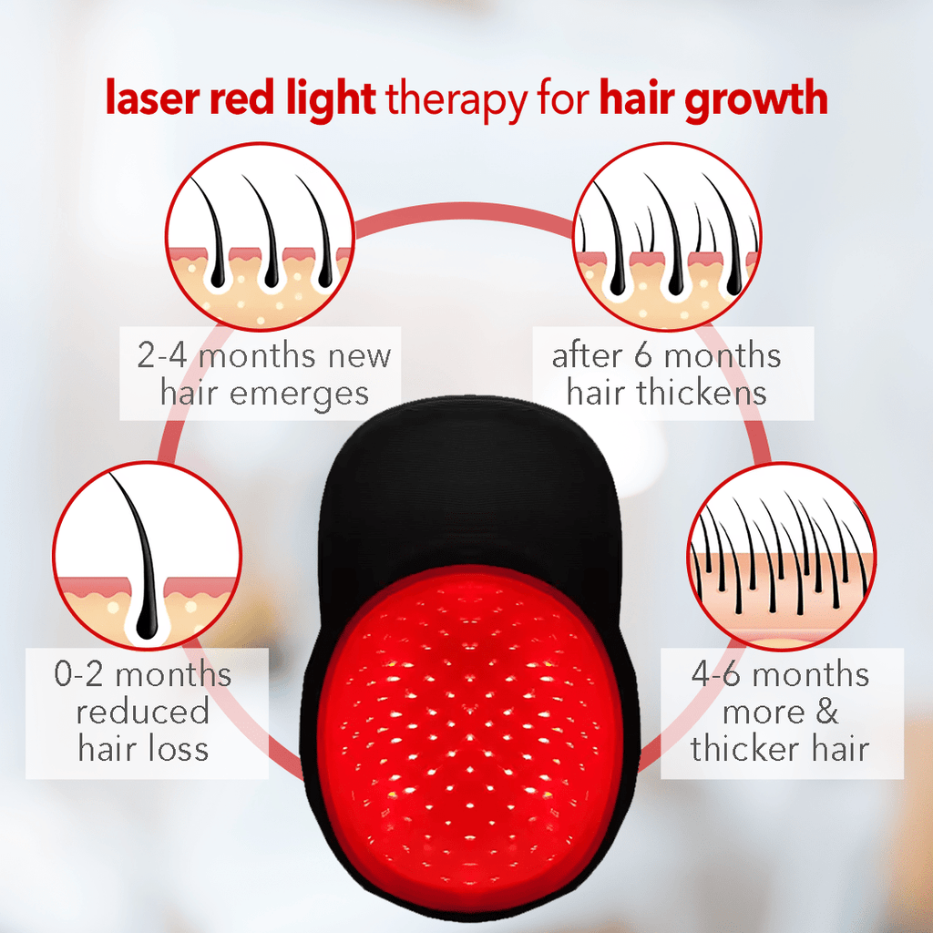 Regenr8™ Pro - 272 Laser Red Light Therapy Cap for Hair Growth (Black) - The Red Light Store