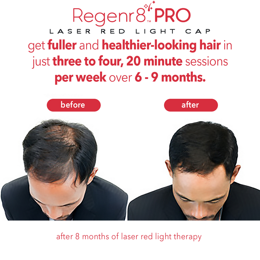Regenr8™ Pro - 272 Laser Red Light Therapy Cap for Hair Growth (Black)
